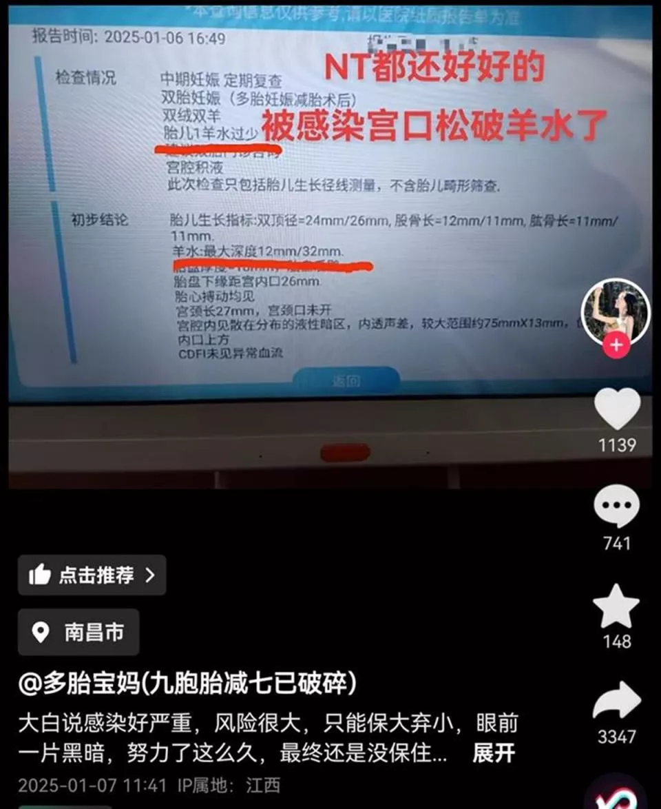 9胞胎妈妈减胎后剩下的两胎也没保住,丈夫:保大人