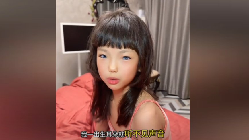 中国8岁女孩患怪病 出生不久眼睛变蓝色（视频）
