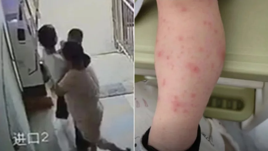 1岁多男孩遭女子强搂亲吻当晚高烧,妈妈怒回:确诊是水痘