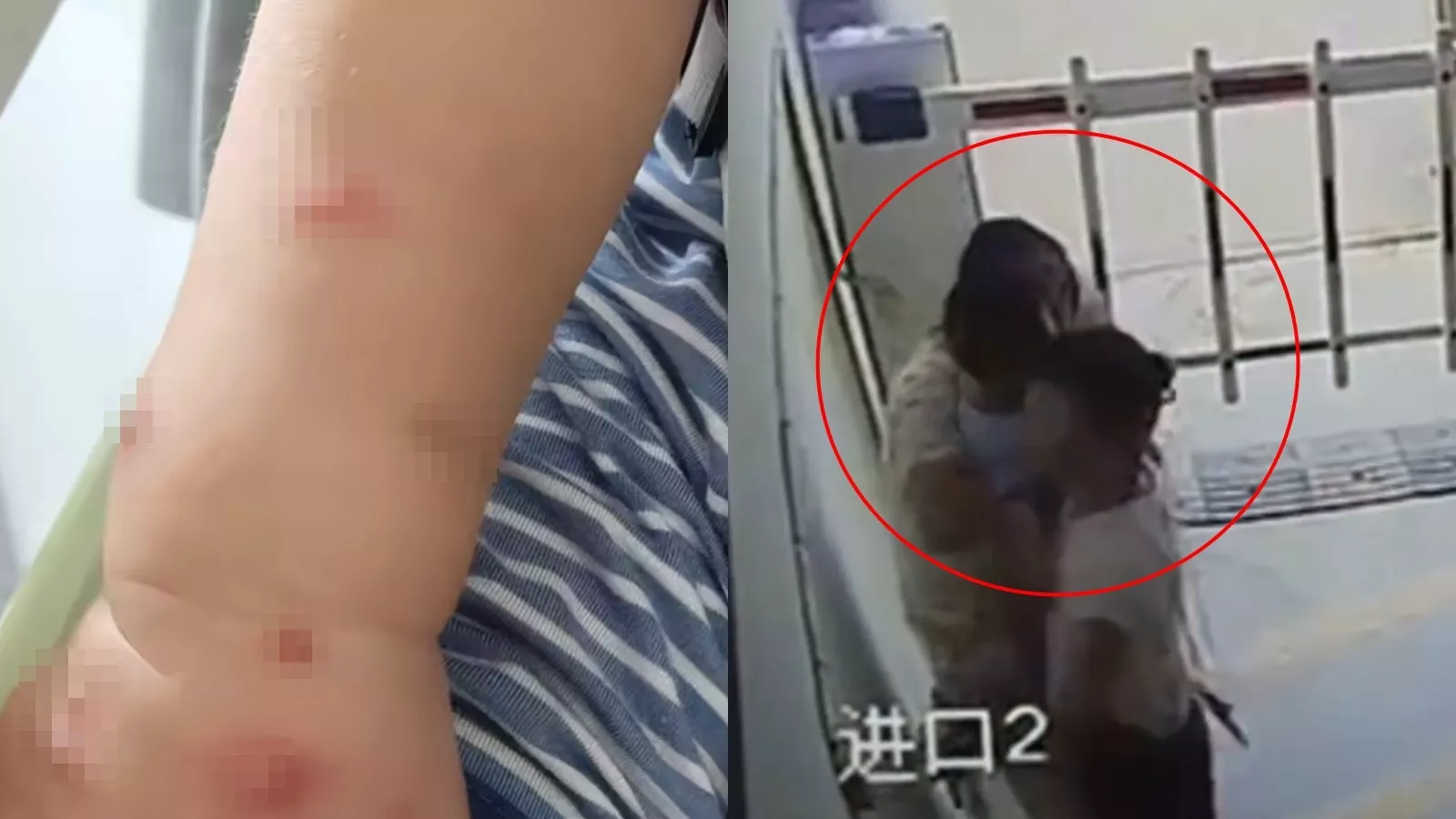 湖南1岁男童突遭陌生女强搂亲吻 男童当晚高烧……