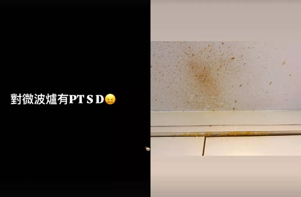 女演员微波炉煮鸡蛋被炸伤眼睛：眼角膜破了一个大洞
