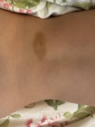 竹市又传私幼老师施暴 数名孩童遭闪耳光、捏大腿、转耳朵