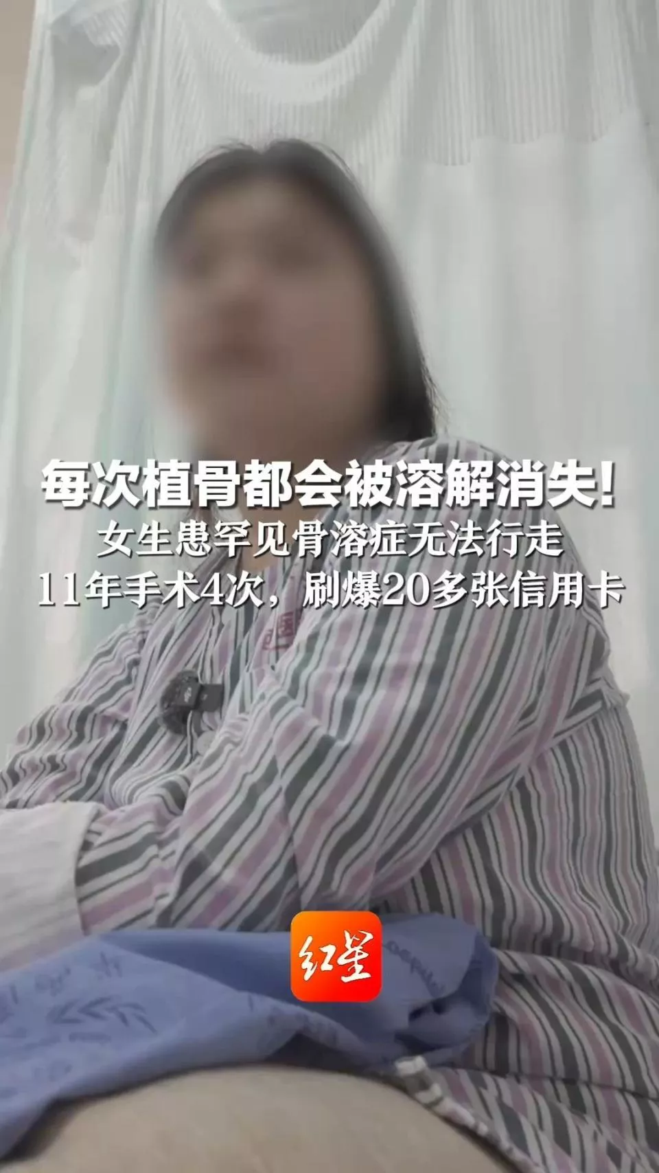 女孩15岁时摔伤手术后大腿骨头“消失”:每次植骨后都会溶解