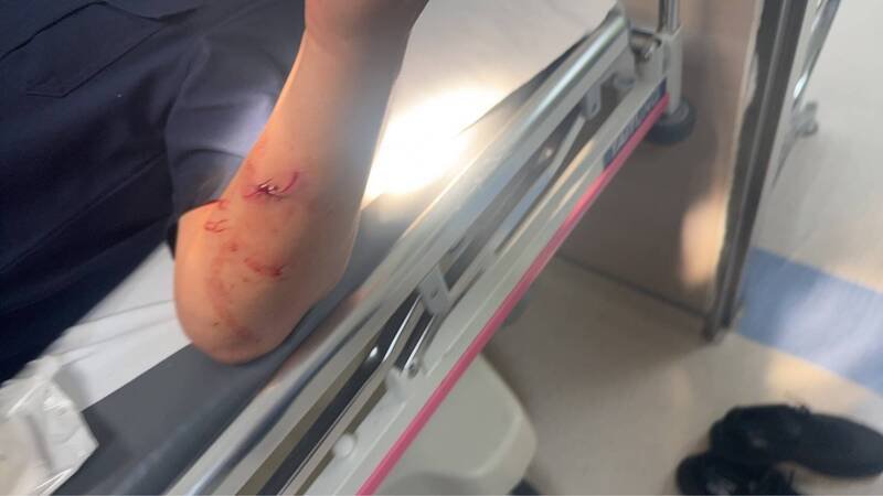 1名员警左手臂受伤就医缝治3针，幸无大碍。（民众提供）