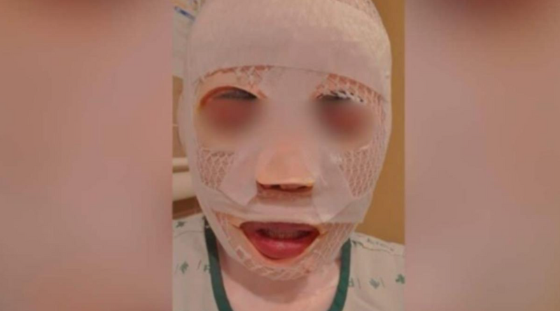 韩夫因妒念泼热水致妻烫伤，引发社会哗然。（撷取自脸书@Olay Somruethai）