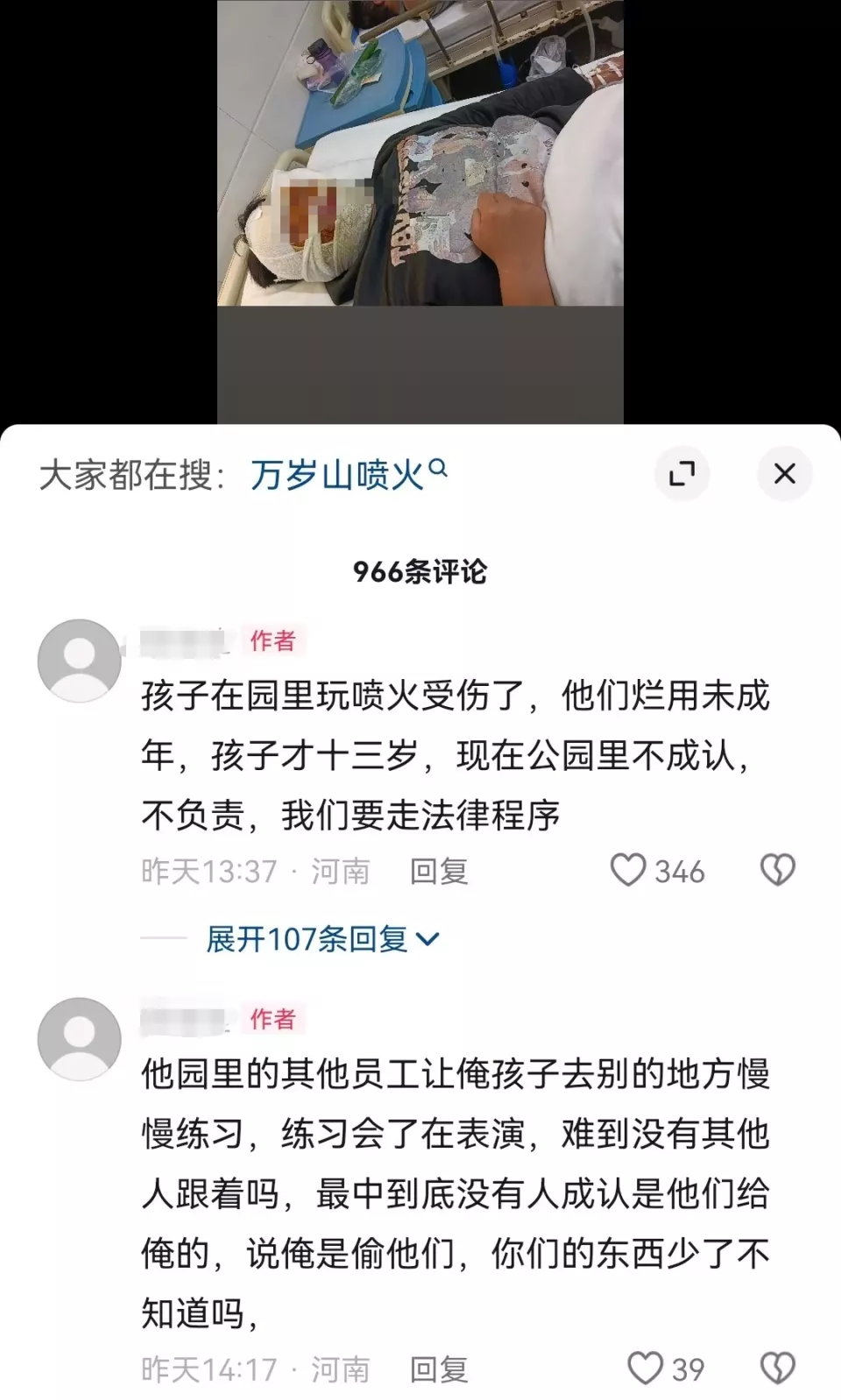 13岁男孩练习喷火表演被烧伤？河南万岁山景区：他是游客