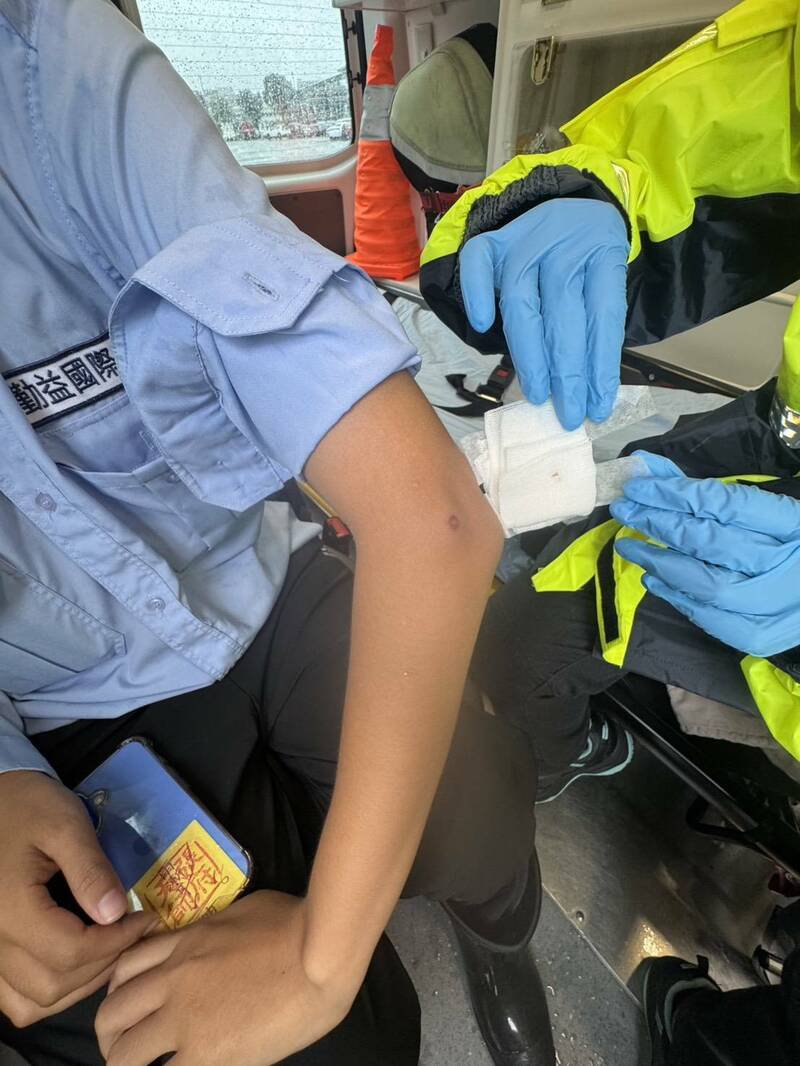 女警卫(保全)右手肘被钢珠击中,治疗后无大碍。(记者张瑞桢翻摄) 女警卫(保全)右手肘被钢珠击中,治疗后无大碍。(记者张瑞桢翻摄)