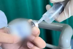 1针10万元   渐冻症精准治疗药物在中国成功注射