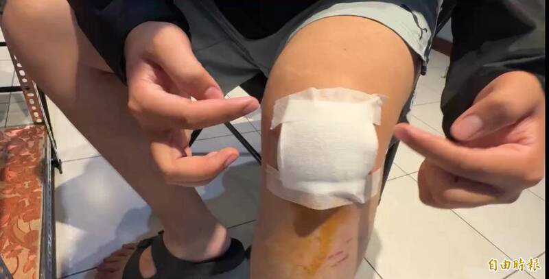 赖姓男子在基隆中山隧道看到长发女子后连日心神不宁摔车,手肘和膝盖受伤。(记者卢贤秀摄) 赖姓男子在基隆中山隧道看到长发女子后连日心神不宁摔车,手肘和膝盖受伤。(记者卢贤秀摄)